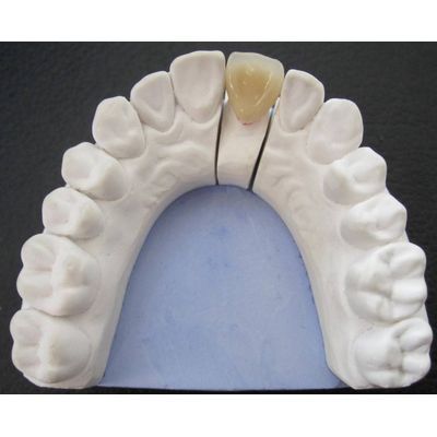 5 axis cnc machine for jewellery, best cnc machine for jewelry, cnc machine for gold jewellery, cnc machine for gold jewellery price, cnc machine for jewellery, cnc machine for jewelry making, cnc jewellery cutting machine,5 axis cnc machine, 5 axis cnc milling machine, 5 axis machining, 5 axis milling machine, 5th axis cnc machine, 5 Axis CNC Machine Manufacturers,