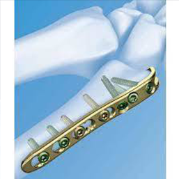 5 axis cnc machine for ortho implants, impeller machine, impeller machining, 5 axis impeller, 5 axis impeller machining, 5 axis cnc impeller,